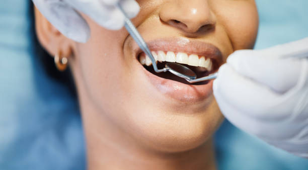 Best Cosmetic Emergency Dentistry in Wasco, CA